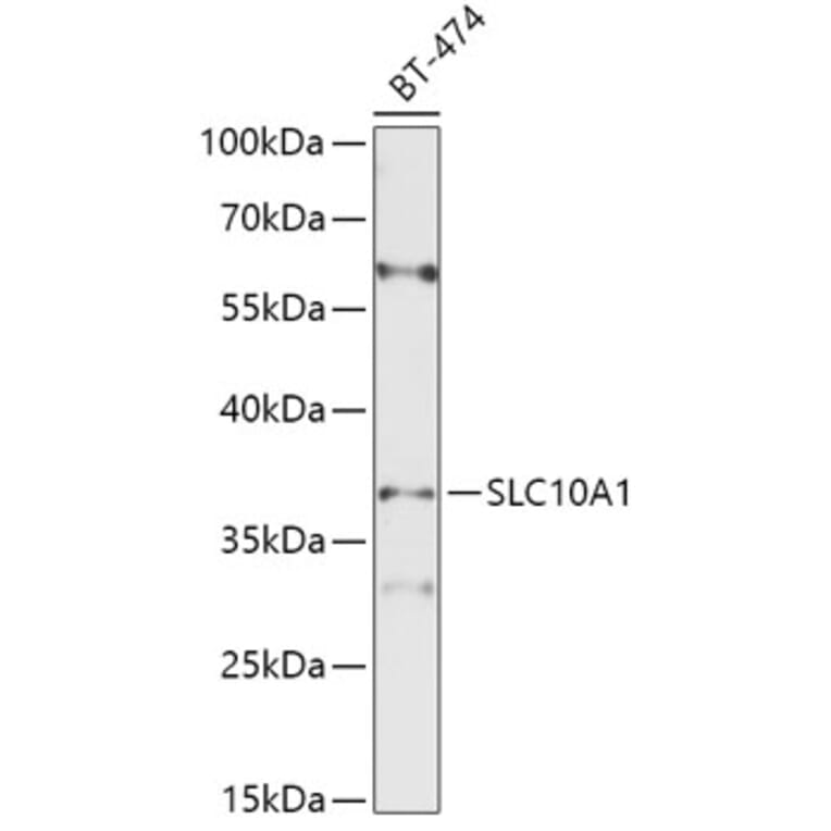Western Blot - Anti-SLC10A1 / NTCP1 Antibody (A8560) - Antibodies.com