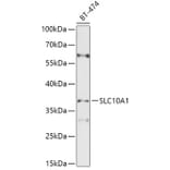 Western Blot - Anti-SLC10A1 / NTCP1 Antibody (A8560) - Antibodies.com