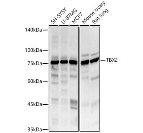Western Blot - Anti-Tbx2 Antibody (A8561) - Antibodies.com