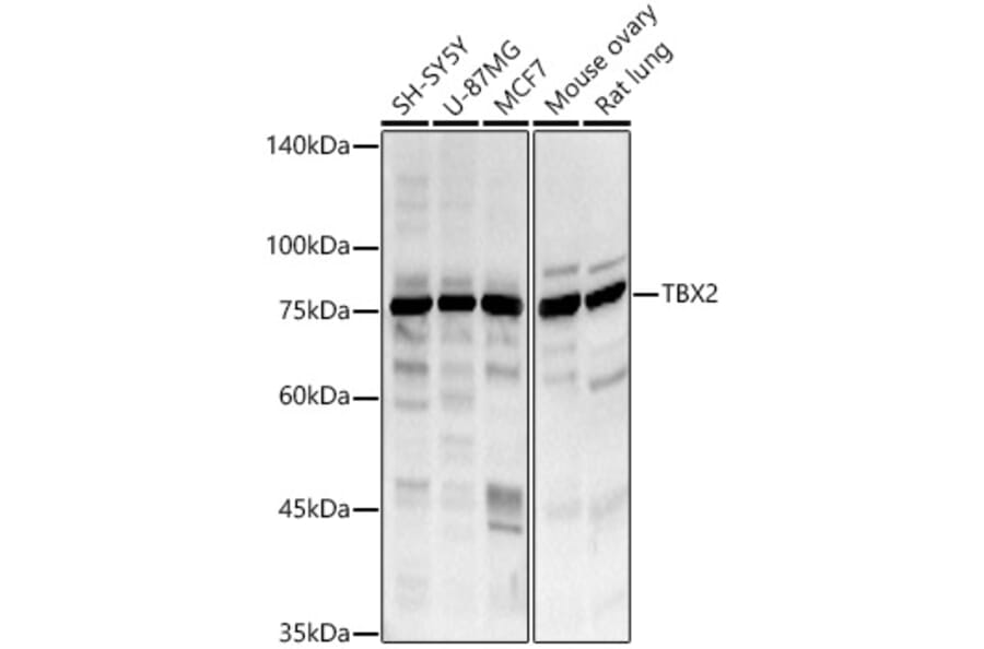 Western Blot - Anti-Tbx2 Antibody (A8561) - Antibodies.com