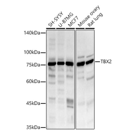 Western Blot - Anti-Tbx2 Antibody (A8561) - Antibodies.com