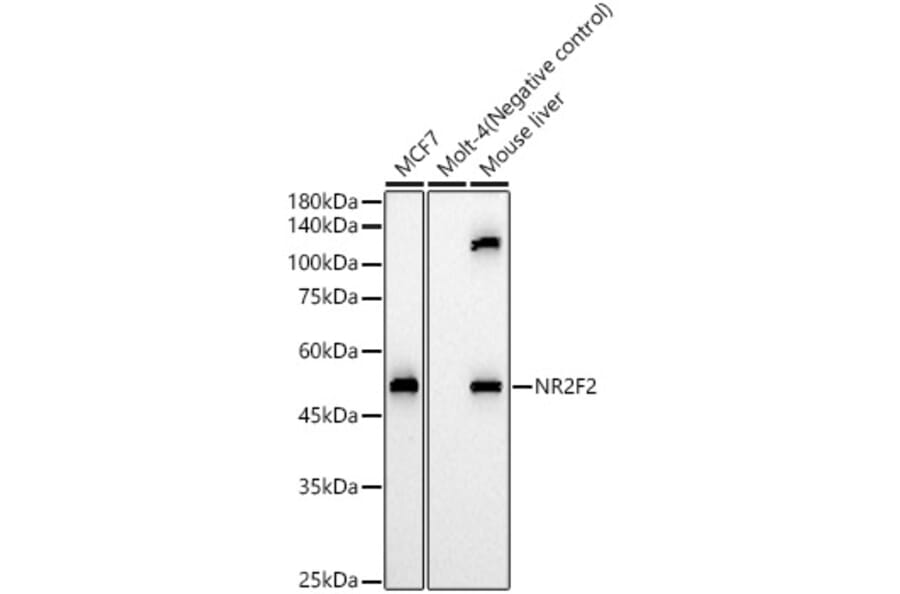 Western Blot - Anti-NR2F2 Antibody (A8562) - Antibodies.com