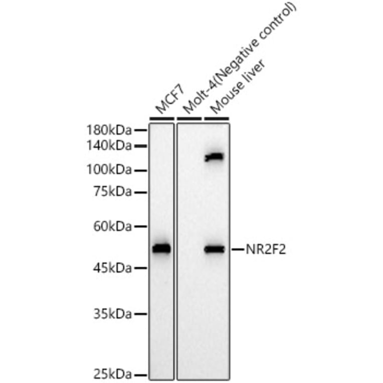 Western Blot - Anti-NR2F2 Antibody (A8562) - Antibodies.com