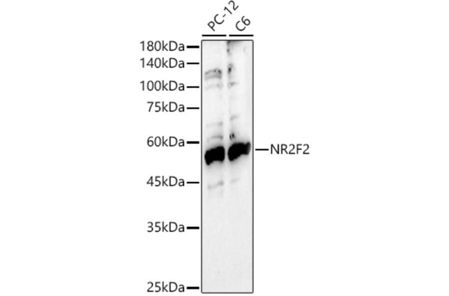 Western Blot - Anti-NR2F2 Antibody (A8562) - Antibodies.com
