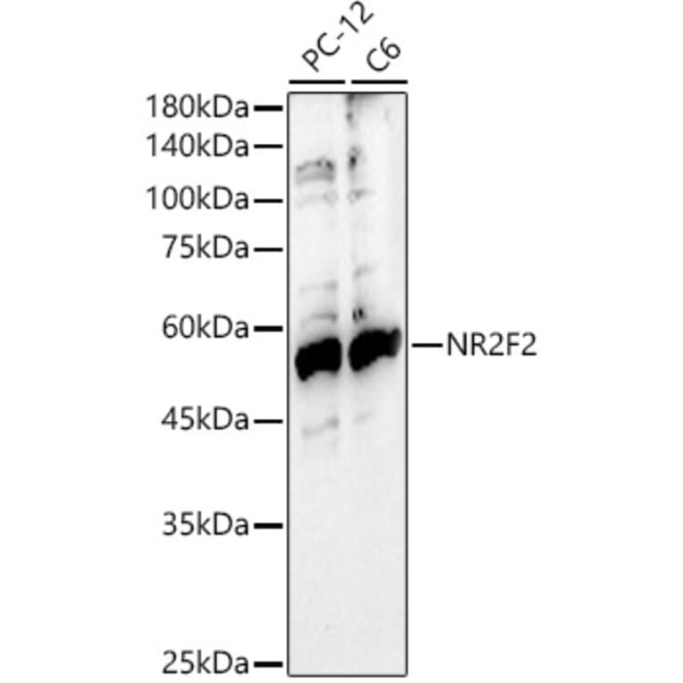 Western Blot - Anti-NR2F2 Antibody (A8562) - Antibodies.com