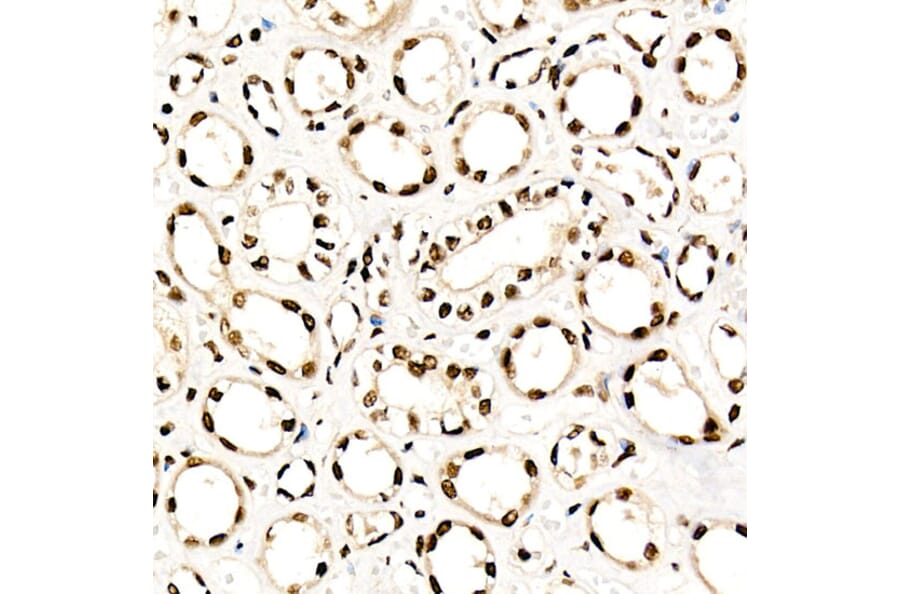 Immunohistochemistry - Anti-NR2F2 Antibody (A8562) - Antibodies.com