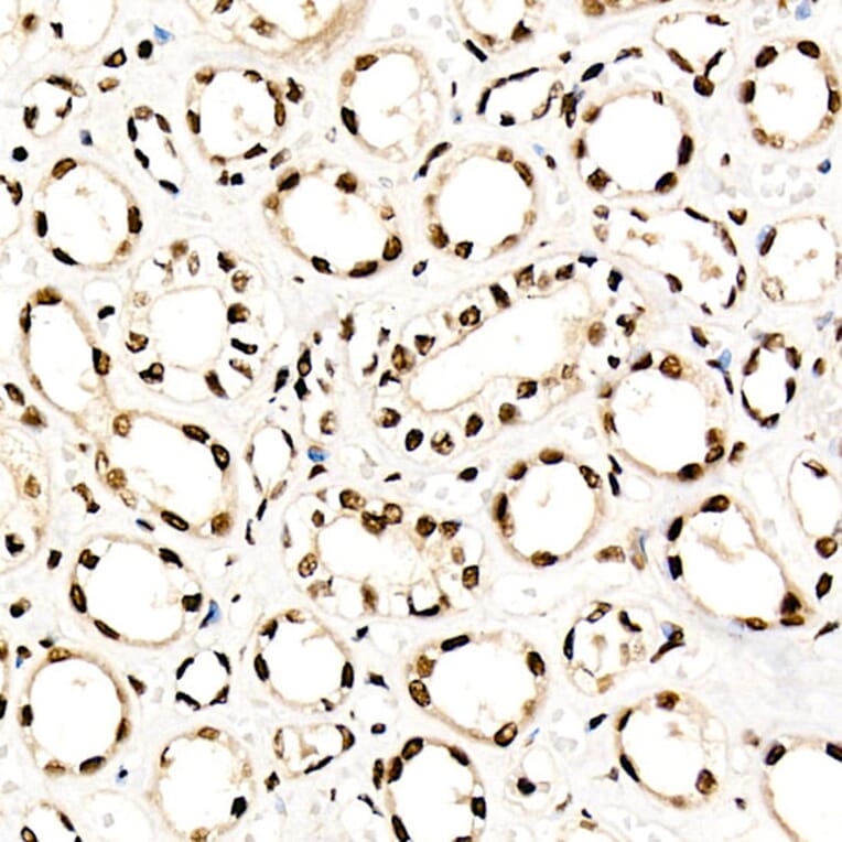 Immunohistochemistry - Anti-NR2F2 Antibody (A8562) - Antibodies.com