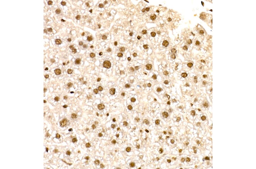 Immunohistochemistry - Anti-NR2F2 Antibody (A8562) - Antibodies.com