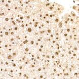 Immunohistochemistry - Anti-NR2F2 Antibody (A8562) - Antibodies.com