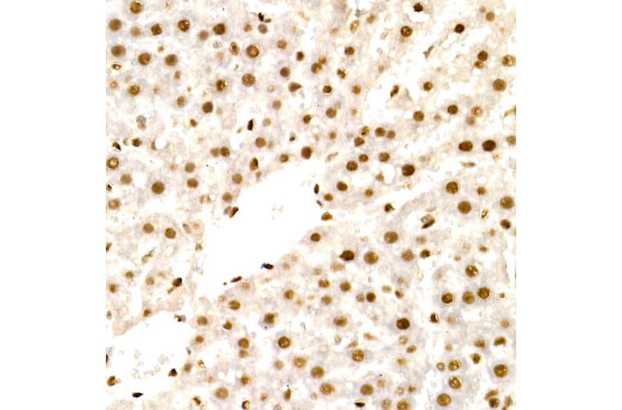 Immunohistochemistry - Anti-NR2F2 Antibody (A8562) - Antibodies.com