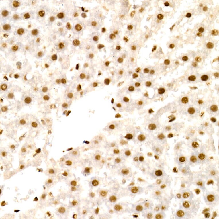 Immunohistochemistry - Anti-NR2F2 Antibody (A8562) - Antibodies.com