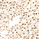 Immunohistochemistry - Anti-NR2F2 Antibody (A8562) - Antibodies.com