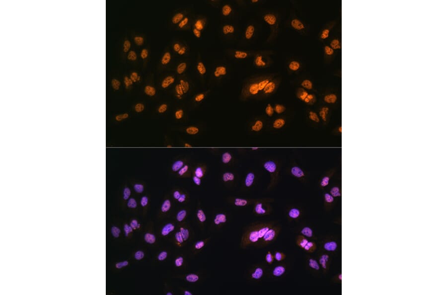 Immunofluorescence - Anti-NR2F2 Antibody (A8562) - Antibodies.com