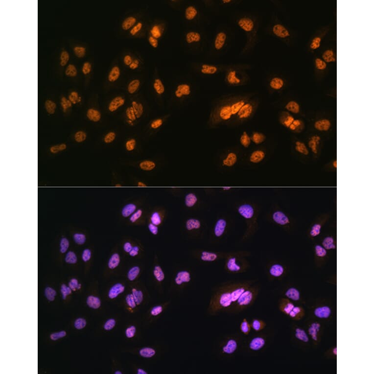 Immunofluorescence - Anti-NR2F2 Antibody (A8562) - Antibodies.com