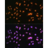 Immunofluorescence - Anti-NR2F2 Antibody (A8562) - Antibodies.com