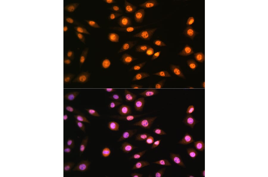 Immunofluorescence - Anti-NR2F2 Antibody (A8562) - Antibodies.com