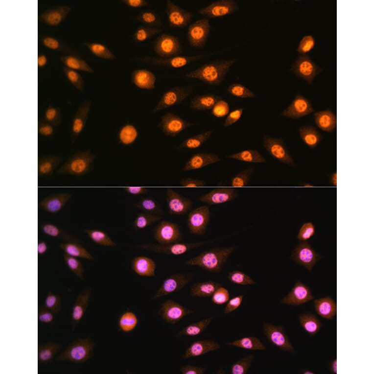 Immunofluorescence - Anti-NR2F2 Antibody (A8562) - Antibodies.com