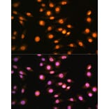 Immunofluorescence - Anti-NR2F2 Antibody (A8562) - Antibodies.com