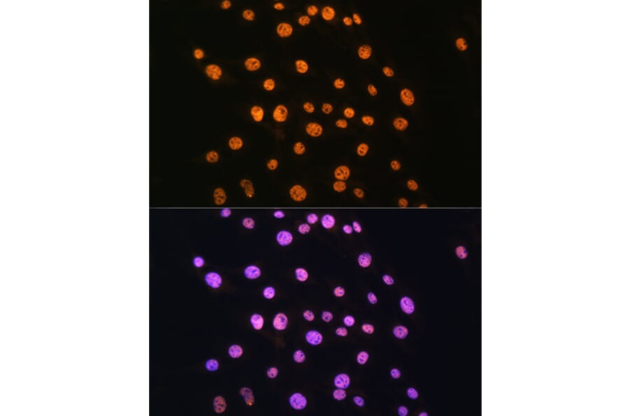 Immunofluorescence - Anti-NR2F2 Antibody (A8562) - Antibodies.com