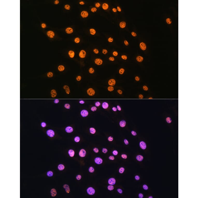 Immunofluorescence - Anti-NR2F2 Antibody (A8562) - Antibodies.com