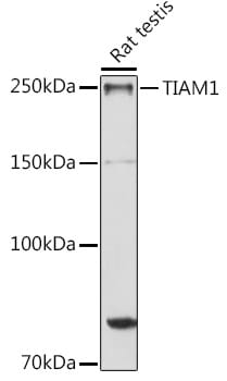 Western blot analysis of extracts of various cell lines, using Anti-TIAM1 Antibody (A10252) at 1:1,000 dilution.
Secondary antibody: Goat Anti-Rabbit IgG (H+L) (HRP) (AS014) at 1:10,000 dilution.
Lysates / proteins: 25µg per lane.
Blocking buffer: 3% non-fat dry milk in TBST.
Detection: ECL Basic Kit (RM00020).
Exposure time: 30s.