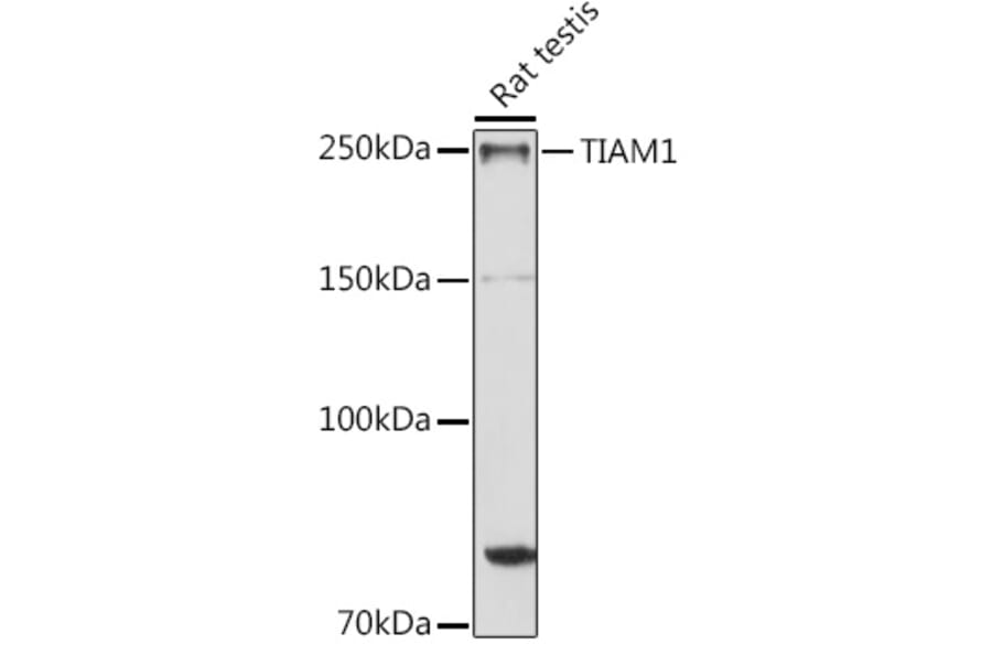 Western Blot - Anti-TIAM1 Antibody (A8563) - Antibodies.com