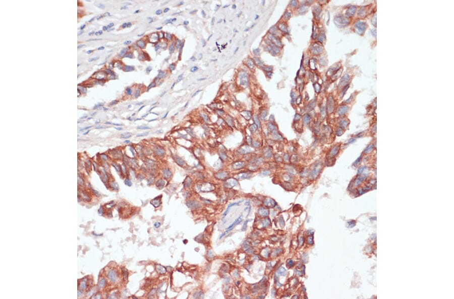 Immunohistochemistry - Anti-TIAM1 Antibody (A8563) - Antibodies.com