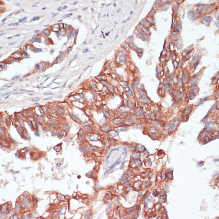 Immunohistochemistry - Anti-TIAM1 Antibody (A8563) - Antibodies.com