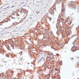 Immunohistochemistry - Anti-TIAM1 Antibody (A8563) - Antibodies.com