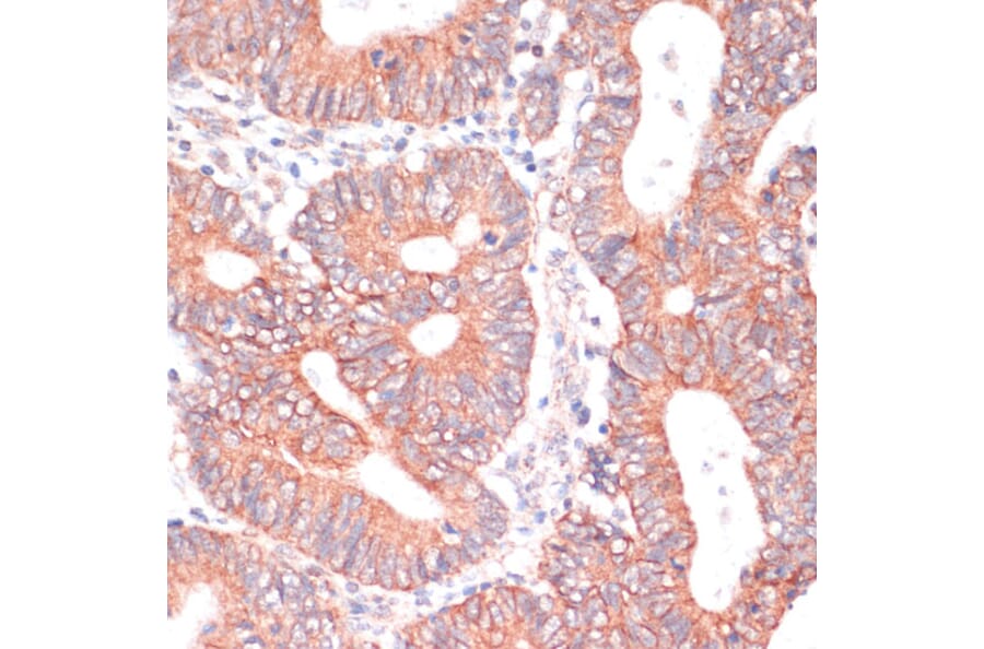 Immunohistochemistry - Anti-TIAM1 Antibody (A8563) - Antibodies.com