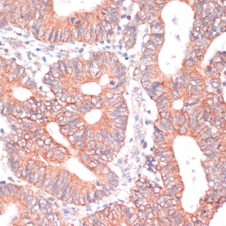 Immunohistochemistry - Anti-TIAM1 Antibody (A8563) - Antibodies.com