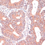 Immunohistochemistry - Anti-TIAM1 Antibody (A8563) - Antibodies.com