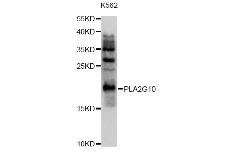 Western Blot - Anti-PLA2G10 Antibody (A10256) - Antibodies.com