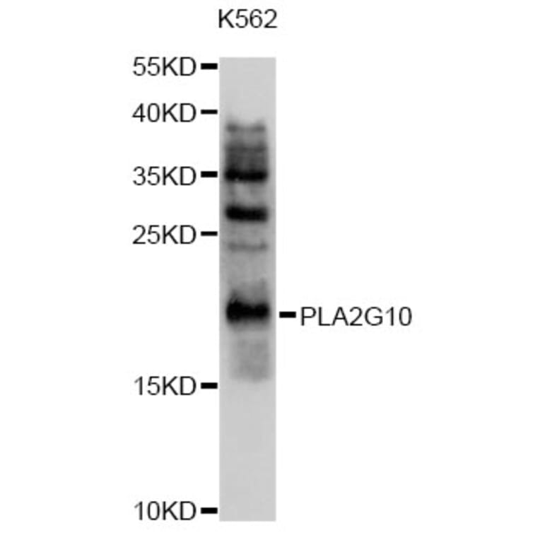 Western Blot - Anti-PLA2G10 Antibody (A10256) - Antibodies.com