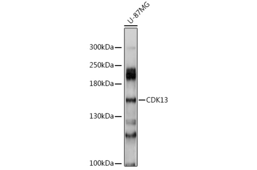 Western Blot - Anti-CDK13 Antibody (A8565) - Antibodies.com