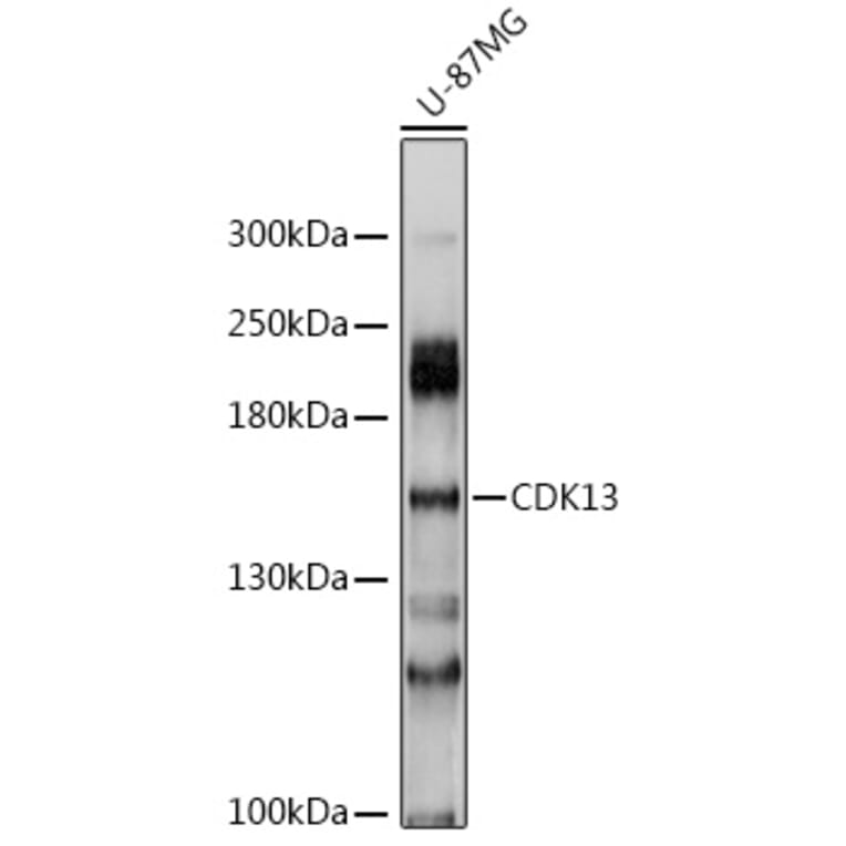Western Blot - Anti-CDK13 Antibody (A8565) - Antibodies.com