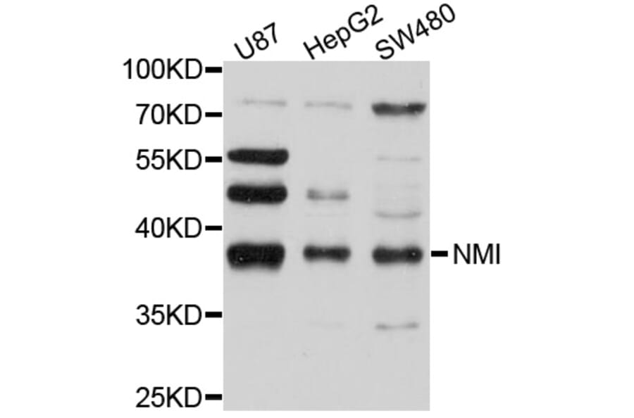 Western Blot - Anti-NMI Antibody (A10265) - Antibodies.com