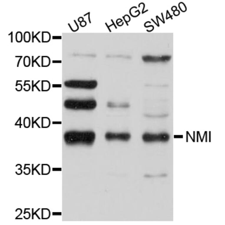 Western Blot - Anti-NMI Antibody (A10265) - Antibodies.com