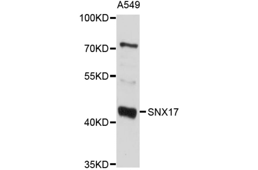Western Blot - Anti-SNX17 Antibody (A10274) - Antibodies.com