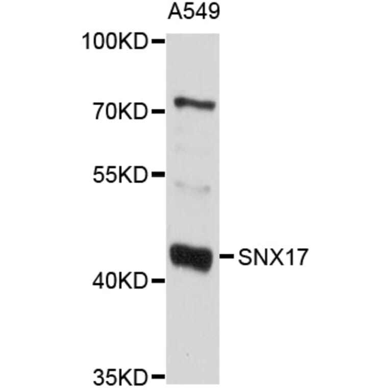 Western Blot - Anti-SNX17 Antibody (A10274) - Antibodies.com