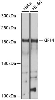 Western blot analysis of extracts of various cell lines, using Anti-KIF14 Antibody (A10275) at 1:1,000 dilution.
Secondary antibody: Goat Anti-Rabbit IgG (H+L) (HRP) (AS014) at 1:10,000 dilution.
Lysates / proteins: 25µg per lane.
Blocking buffer: 3% non-fat dry milk in TBST.
Detection: ECL Basic Kit (RM00020).
Exposure time: 15s.