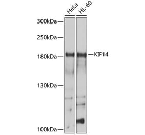 Western Blot - Anti-KIF14 Antibody (A8568) - Antibodies.com