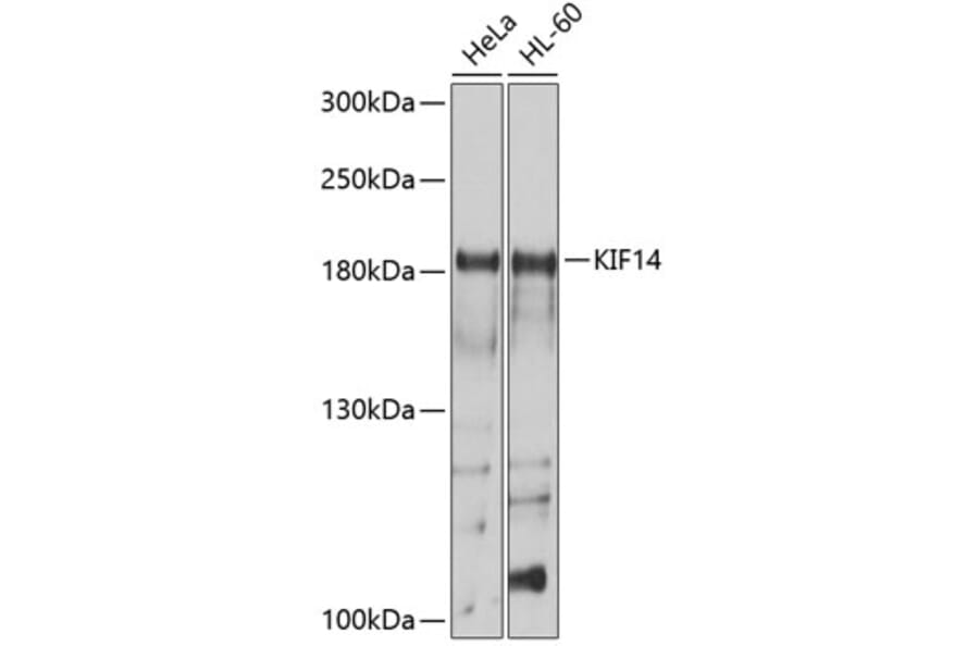 Western Blot - Anti-KIF14 Antibody (A8568) - Antibodies.com