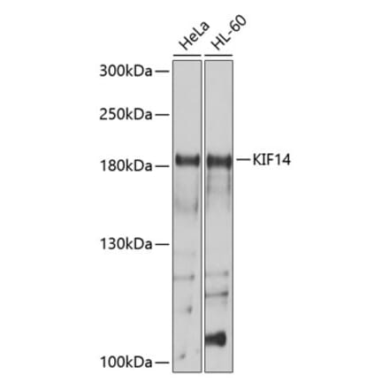 Western Blot - Anti-KIF14 Antibody (A8568) - Antibodies.com
