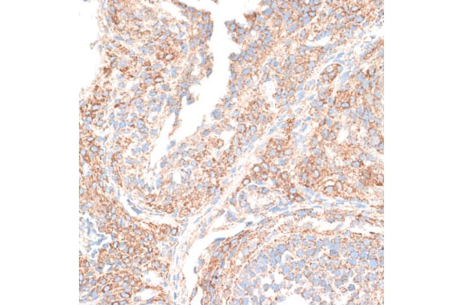Immunohistochemistry - Anti-KIF14 Antibody (A8568) - Antibodies.com
