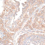 Immunohistochemistry - Anti-KIF14 Antibody (A8568) - Antibodies.com