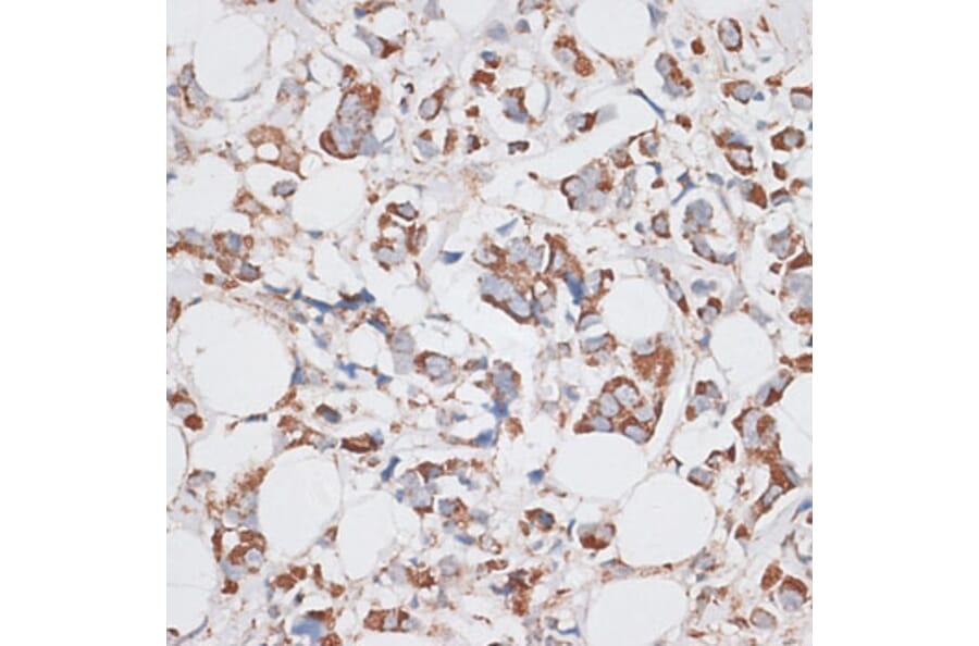 Immunohistochemistry - Anti-KIF14 Antibody (A8568) - Antibodies.com