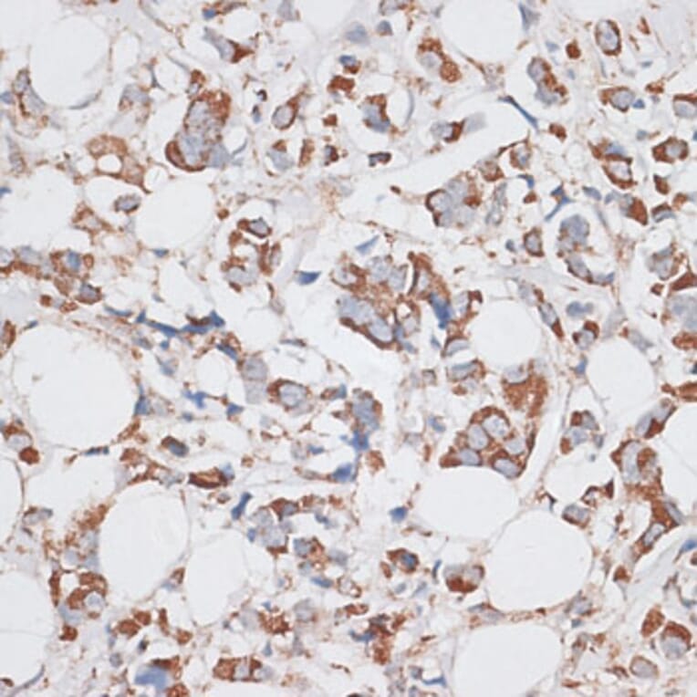 Immunohistochemistry - Anti-KIF14 Antibody (A8568) - Antibodies.com