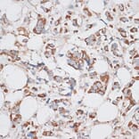 Immunohistochemistry - Anti-KIF14 Antibody (A8568) - Antibodies.com