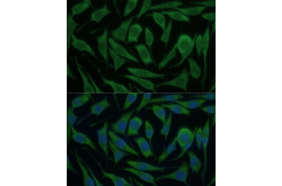 Immunofluorescence - Anti-KIF14 Antibody (A8568) - Antibodies.com